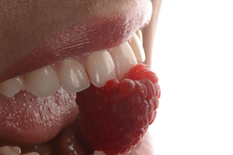 Зъбни корони – видове зъбни корони и протезиране на зъбни импланти