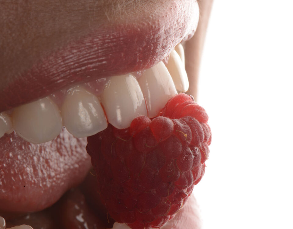 избелване на зъби