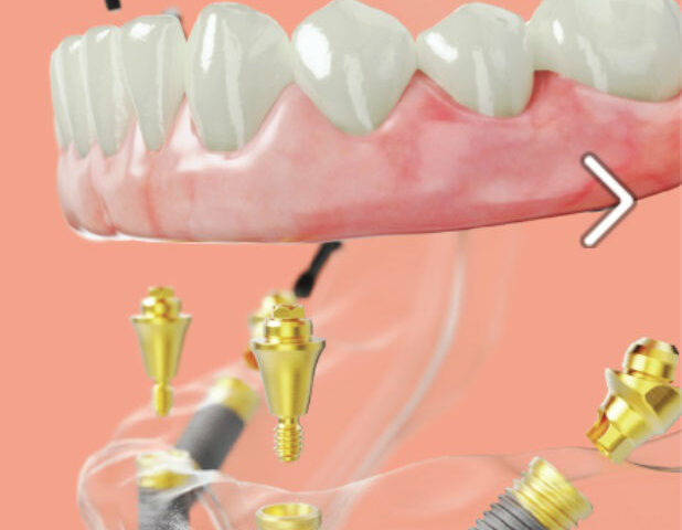 All on 4 Бялата магия