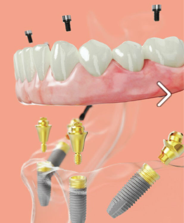 All on 4 Бялата магия