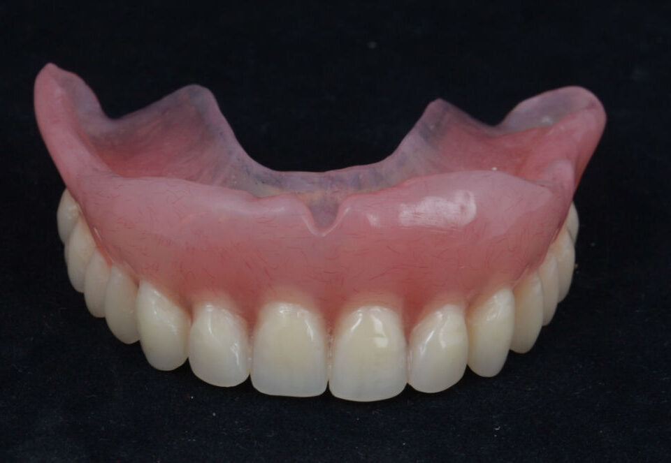 3d-визуализация-на-лечение-без-зъбни-импланти