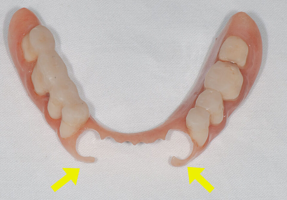 силиконови-зъбни-протези-2