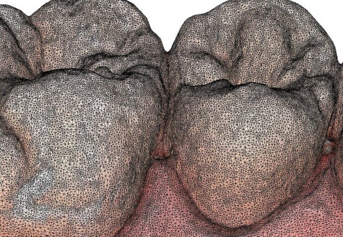 Go-with-the-flow-dentaconsult-implants-Vency-Stankov-crop