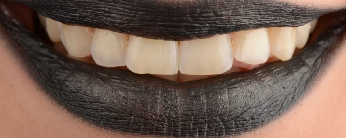 дентална-клиника-поставяне-на-зъбни-импланти-дента-консулт