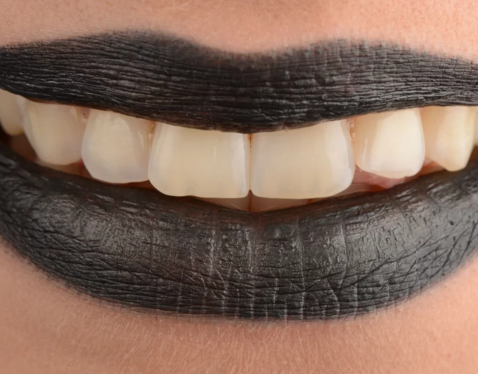 дентална-клиника-поставяне-на-зъбни-импланти-дента-консулт