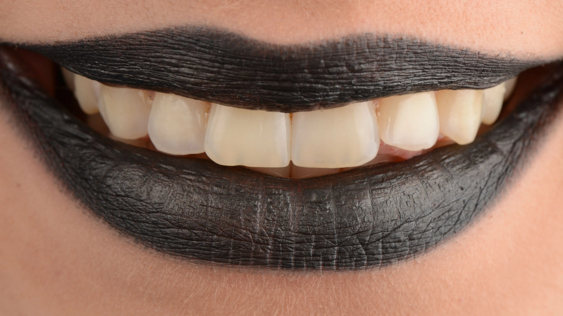 дентална-клиника-поставяне-на-зъбни-импланти-дента-консулт