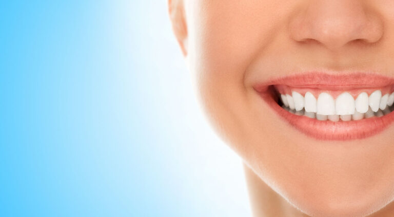 Керамични фасети – естетично лечение и подобряване на усмивката